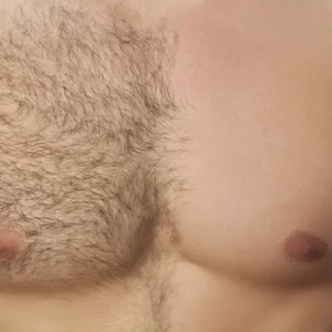 Depilação Masculina